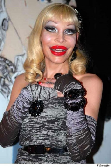 Tuy nhiên, vì quá đam mê trùng tu nhan sắc nên đã biến thành thảm họa thẩm mỹ. Không chỉ thế cô còn thường xuyên diện những trang phục khoe da thịt vô cùng táo bạo. Đôi môi quá khổ, đôi mắt bé xếch ngược, làn da bơm nhiều botox căng giả tạo, đặc biệt là vòng 1 như chỉ trực nổ tung.