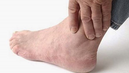 Trong giai đoạn toàn phát, bệnh còn biểu hiện ở các bộ phận khác của cơ thể như tim, phổi, thận,… như viêm cơ tim, màng tim gây suy tim, viêm phổi, màng phổi cũng hay gặp và có thể suy hô hấp.