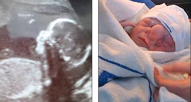 Tuy nhiên, những lời bình luận khiếm nhã của một số người, như cậu bé thật "xấu xí" và "lẽ ra không nên được sinh ra" mới là điều khiến Amy Poole, mẹ của Trezise, buồn hơn cả.