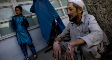 Mặc dù bệnh nhân nhiễm loại bệnh này có thể được chữa khỏi nhanh chóng bằng những loại thuốc đơn giản, nhưng việc các tay súng IS từ chối điều trị y tế và cố tình ném xác bệnh nhân nhiễm bệnh ra ngoài đường đã dẫn đến sự lây lan ngày càng nhanh chóng loại virus nguy hiểm trên.