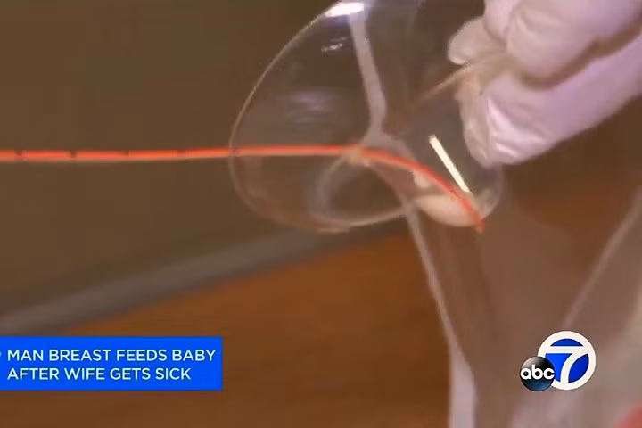 Đầu cuối của thiết bị cho bú, nơi em bé sẽ ngậm để bú. Thiết bị này vốn để hỗ trợ các người mẹ gặp khó khăn trong việc cho con bú hoặc những người mẹ nuôi (ảnh: ABC7).