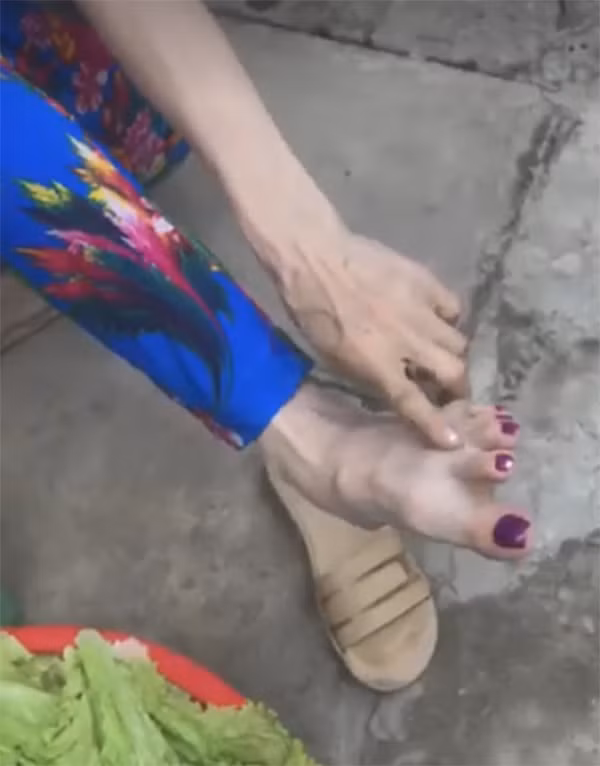 Bộ móng 9,2 triệu cho một bên chân.