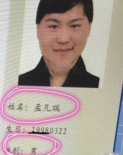 Cư dân mạng cũng đã phát hiện một bức ảnh được cho là Abby trước khi phẫu thuật thẩm mỹ.