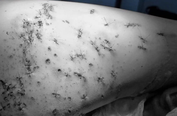 Tai nan do phao no va cach so cuu ai cung nen biet-Hinh-2