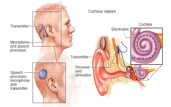 Loat bien chung nguy hiem khi cay oc tai dien tu