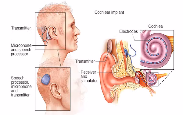 Loat bien chung nguy hiem khi cay oc tai dien tu