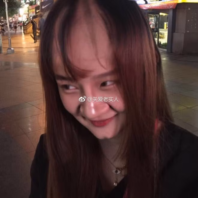 Mắt cô nàng bé hơn rất nhiều, còn sưng húp, chiếc mũi cao thẳng đâu không thấy chỉ có một chiếc mũi to bè cực thô. Hành động cử chỉ của cô gái cũng rất thiếu nữ tính khiến chàng trai khó lòng chấp nhận việc có nên hẹn hò tiếp anh không.