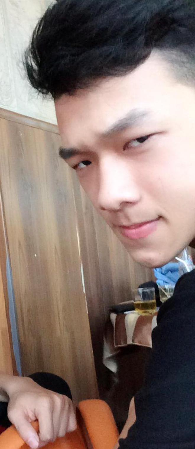 Hoàng kể đợt 2 là tiểu phẫu nên diễn ra trong khoảng 4 tiếng. Lần này cậu có thể cảm nhận được những gì bác sĩ đang làm với mình và nhận thấy không quá đau đớn.