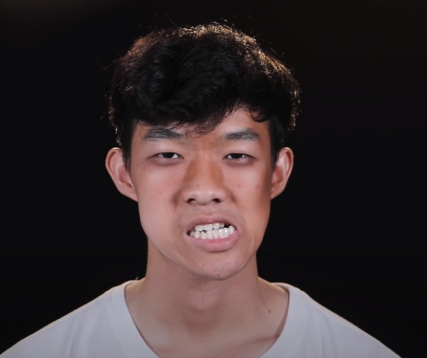 Được biết, trước khi có được ngoại hình như hiện tại, Minh Hoàng bị tai nạn khi ra ngoài cùng mẹ. Vụ tai nạn tưởng chừng cứ thế trôi đi nhưng khi cậu bước vào năm học lớp 9 thì bỗng nhận ra mình đang có di chứng lệch miệng.