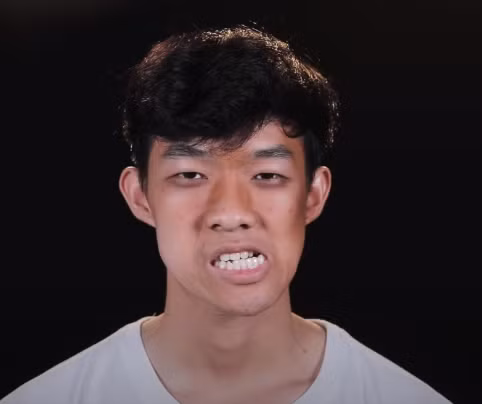 Được biết, trước khi có được ngoại hình như hiện tại, Minh Hoàng bị tai nạn khi ra ngoài cùng mẹ. Vụ tai nạn tưởng chừng cứ thế trôi đi nhưng khi cậu bước vào năm học lớp 9 thì bỗng nhận ra mình đang có di chứng lệch miệng.