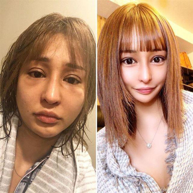 Trải qua nhiều sự tủi nhục và hết sức chịu đựng, cô gái Nhật đã quyết tâm thay đổi ngoại hình bản thân và tìm đến thẩm mỹ.