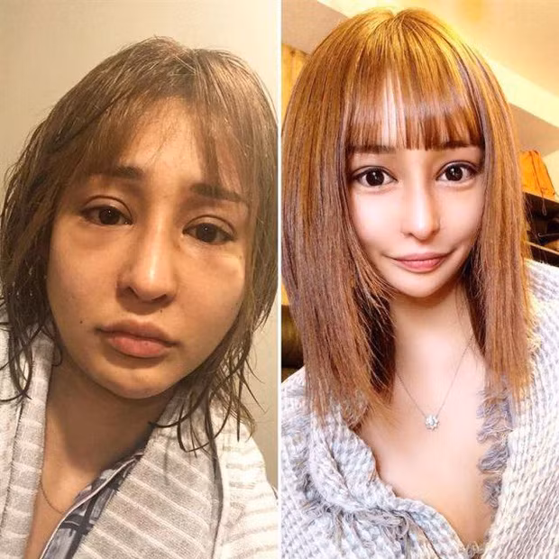 Trải qua nhiều sự tủi nhục và hết sức chịu đựng, cô gái Nhật đã quyết tâm thay đổi ngoại hình bản thân và tìm đến thẩm mỹ.
