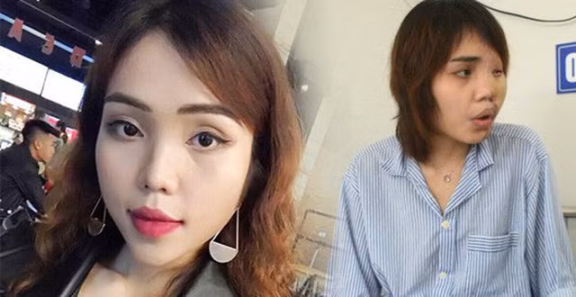 Những nỗi đau về thể xác lẫn tinh thần vẫn luôn thường trực bên cạnh cô gái nhỏ, ai chứng kiến cũng phải xót xa, thương cảm.