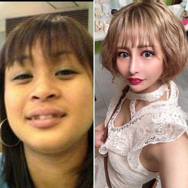 Dù trải qua nhiều đau đớn và phải chi rất nhiều tiền cho thẩm mỹ nhưng bản thân cô nàng hoàn toàn không hối hận, cô thấy hài lòng về kết quả này.