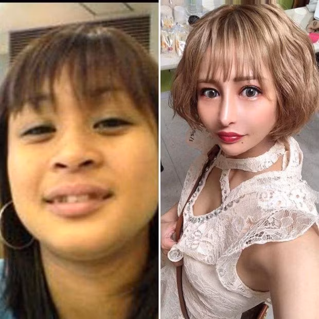 Dù trải qua nhiều đau đớn và phải chi rất nhiều tiền cho thẩm mỹ nhưng bản thân cô nàng hoàn toàn không hối hận, cô thấy hài lòng về kết quả này.