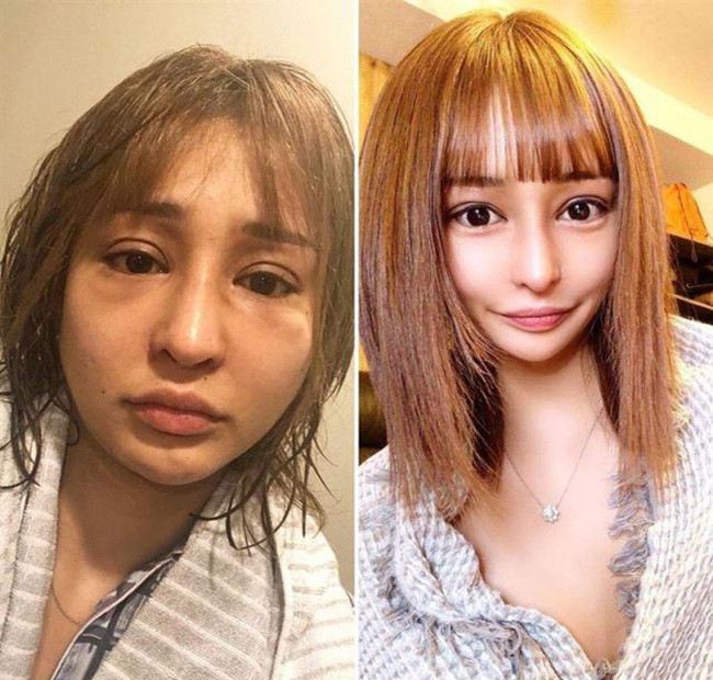 Trong một chương trình truyền hình Nhật Bản, cô gái này từng chia sẻ, bản thân từng rất tự ti vì ngoại hình kém sắc với gương mặt vuông, làn da ngăm, mũi tẹt và hàm răng khấp khểnh. Cô thậm chí bị bạn bè chê giống "khỉ đột".