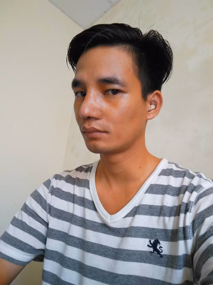 Ngoài sửa mũi, 8X quê Hải Dương còn tuyên bố sẽ nhấn mí và sửa răng để không ai còn nhận ra Lệ Rơi hay từ giờ ra đường không bị ai nhận ra gọi là Lệ Rơi nữa.