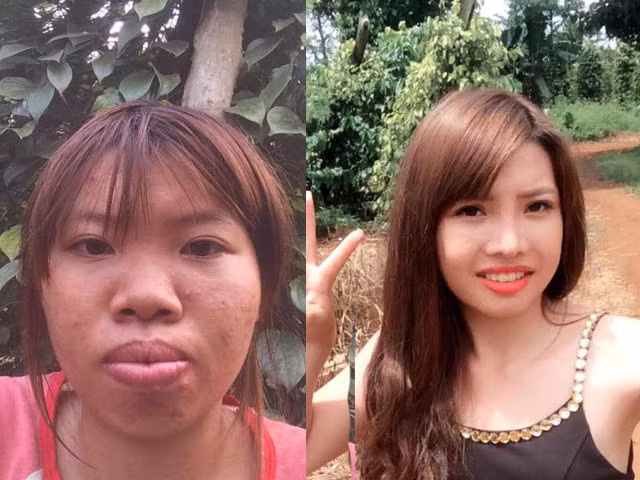 Từ một cô gái quê, bà mẹ đơn thân 9X ở Đăk Nông với biệt danh Phượng "Thị Nở" bỗng nhận được nhiều sự quan tâm của dư luận nhờ câu chuyện "lột xác" thành công sau phẫu thuật thẩm mỹ "đập đi xây lại" khuôn mặt. Ảnh: FBNV.