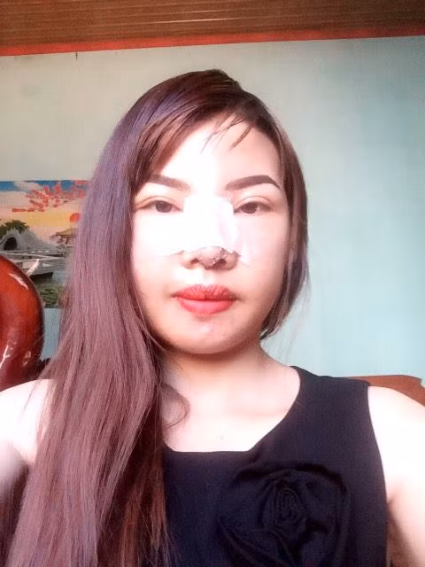 Không chỉ quyết định "làm liều" để bản thân cảm thấy thêm tự tin, Phượng còn mong muốn: "Mình thay đổi để có cơ hội được làm công việc thích, chứ không làm nương rẫy nữa, cực lắm!". Với diện mạo mới sắp hoàn thiện của mình, Kim Phượng đang ấp ủ dự định vào Sài Gòn lập nghiệp và thử sức với một cuộc thi hát nào đó, vì hát là niềm đam mê từ nhỏ của cô.