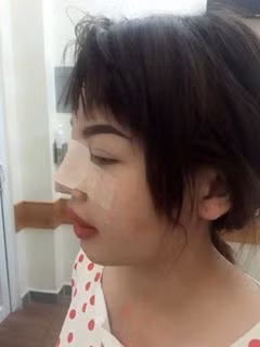 Khi được hỏi có sợ gặp phải những biến chứng sau phẫu thuật thẩm mỹ, bà mẹ đơn thân 9X thẳng thắn thừa nhận: "Mình chấp nhận giảm 10 năm tuổi thọ chỉ để thay đổi nhan sắc. Và càng vui hơn mỗi khi hàng xóm qua nhà chơi và bảo mình quá thay đổi đến nỗi không nhận ra".