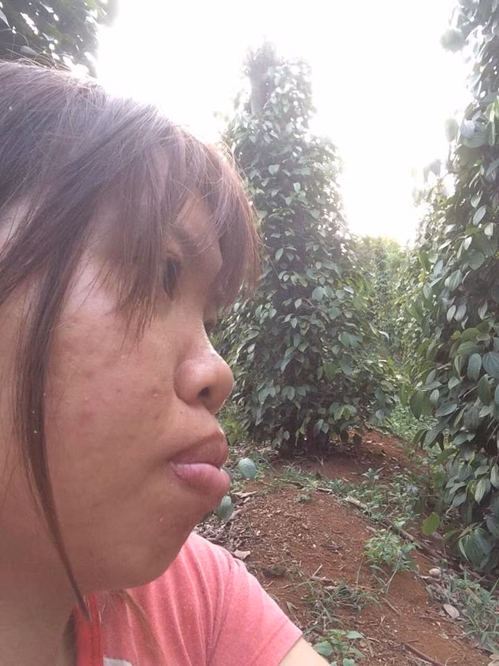 Kim Phượng tâm sự, cô nhận thức được rằng mình có nhan sắc xấu xí bắt đầu từ năm lớp 8, khi thường xuyên bị bạn bè xa lánh và trêu chọc là "bàn nạo dừa" do Phượng sở hữu hàm hô từ nhỏ. Xấu hổ và buồn tủi vì không có bạn bè, cô nữ sinh 9X nghỉ học sớm và theo bố mẹ vào Đăk Nông làm nương rẫy.