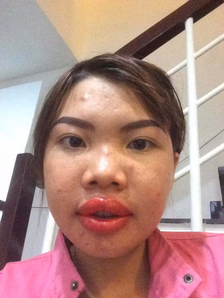 Sức khỏe ổn định sau lần phẫu thuật đầu tiên, Kim Phượng phun môi và chân mày.