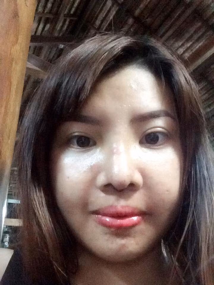 Diện mạo mới xinh đẹp của bà mẹ đơn thân 9X sau khi tháo băng. Mặc dù mặt vẫn còn sưng nhưng có thể thấy Phượng đã đẹp hơn và sở hữu gương mặt rất "Tây" như nhận xét của nhiều người.