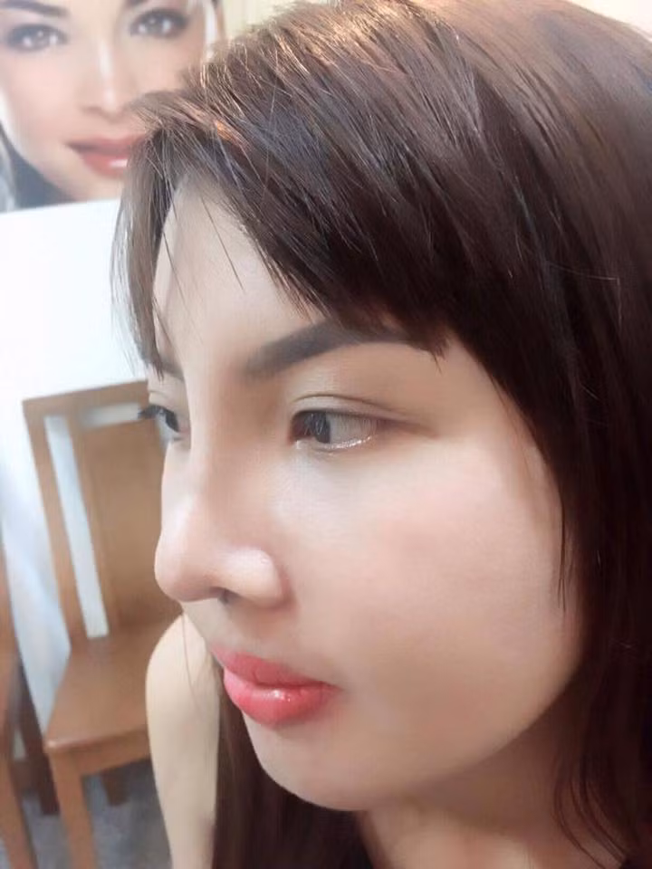 "Nhưng thực tâm mình nghĩ, cho dù có đánh đổi 10 năm tuổi thọ để được xinh đẹp mình cũng đồng ý, vì sống nửa cuộc đời mà được hạnh phúc còn hơn sống cả cuộc đời mà buồn tủi, cô đơn", bà mẹ trẻ bộc bạch.