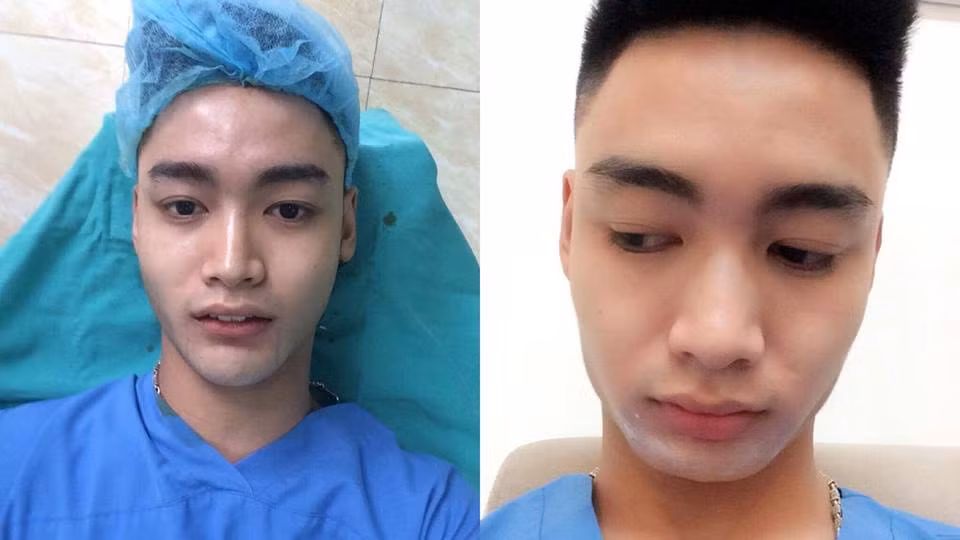 Hiện đang làm công việc của một chuyên viên make-up, stylist, nên Khả Hiếu tự nhận thấy ngoại hình và nhan sắc cũng là một lợi thế trong công việc. Để hiện thực hóa ước mơ muốn bản thân mình đẹp hơn, hot boy đồng tính Hà thành đã "chịu chi" hơn 200 triệu đồng để làm cằm, mũi, tiêm môi, tiêm gọn hàm, nhấn mí mắt, làm răng...