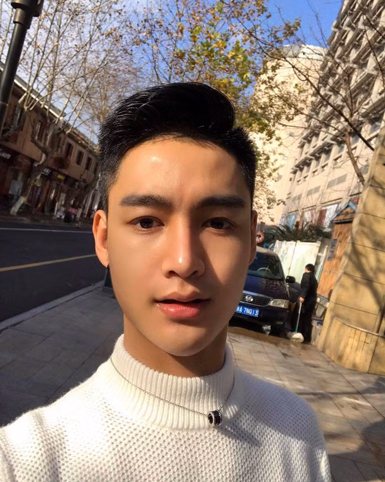 Sau phẫu thuật làm cằm, mũi và tiêm môi, gương mặt của hot boy đồng tính 9X đã trở nên thon gọn và thanh thoát hơn.