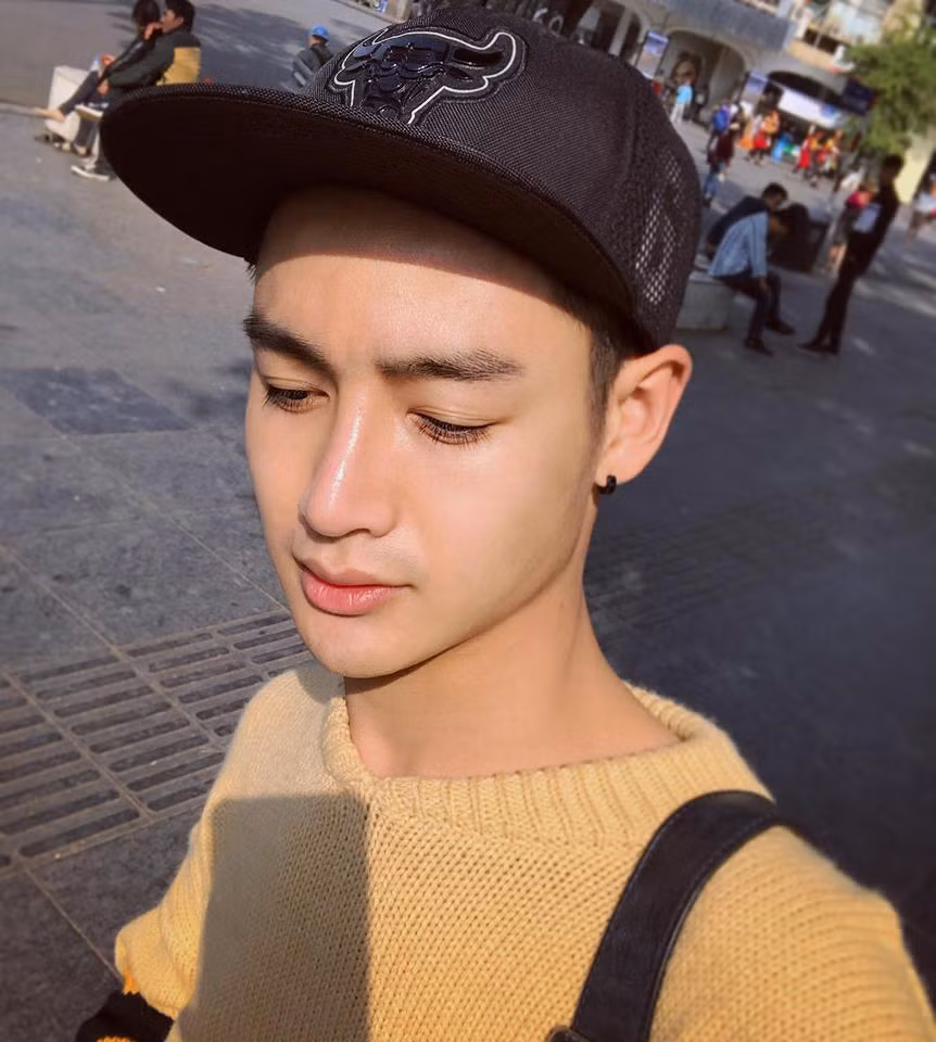 Lần thứ 3 đó là tiêm môi. Môi trên của mình bị chóc lõm, lệch hàm nên môi lệch theo. Mình đã phải tiêm filler vào môi để cho cân môi và đẹp hơn. Tiêm môi ủ tê 30 phút, chọc vào nhói 1 cái rồi hết luôn, về nhà ngậm alphachoay (thuốc giảm đau) khoảng 3 ngày đã có môi như ý. Lưu ý: Đừng ham tiêm filler rẻ về môi sẽ cứng và không tự nhiên, có thể thành cục không tan!"