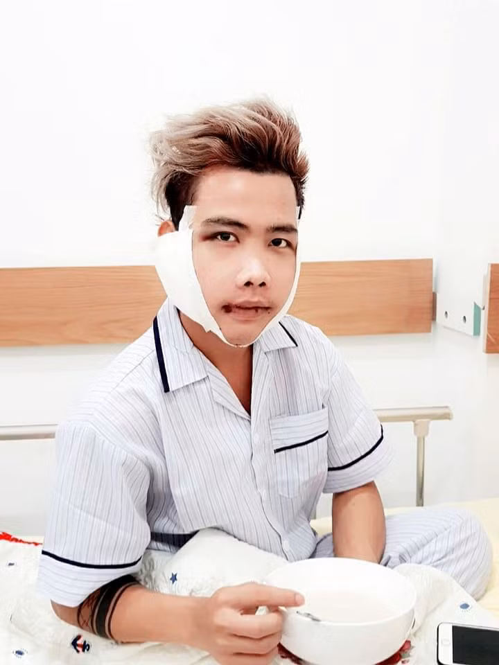 Hình ảnh của Tùng Sơn chỉ sau 3 ngày phẫu thuật thay đổi toàn diện khung xương hàm mặt (xương gò má, xương hàm trên, hàm dưới, góc hàm và xương cằm). Anh chàng còn nêu quan điểm: "Không có người phụ nữ nào xấu cả mà là người ta chưa muốn làm đẹp thôi... Phẫu thuật xong em xin đọ sắc cùng Ngọc Trinh nhé!".