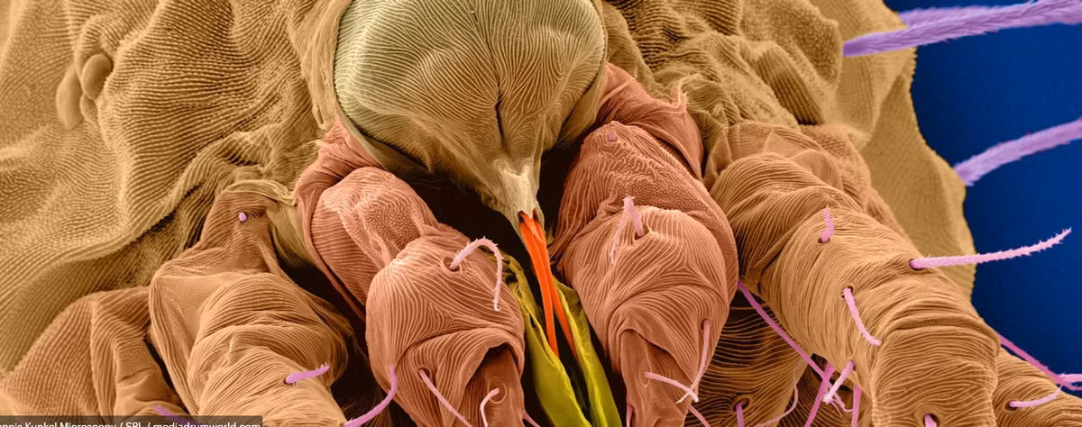 Nhện đỏ châu Âu có thể được tìm thấy ở mọi ngôi nhà.