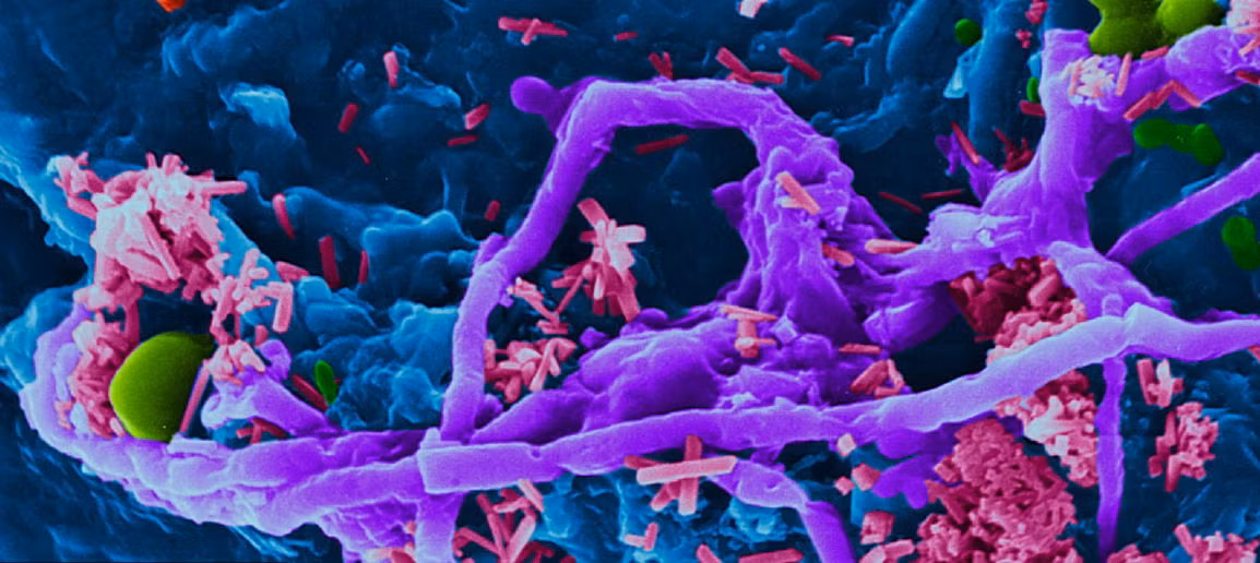 Trong hình là các vi khuẩn trên một chiếc thớt đã rửa sạch sẽ. Những con vi khuẩn nhà bếp có thể tích tụ trong thức ăn và trong một thời gian dài không thể làm sạch triệt để.