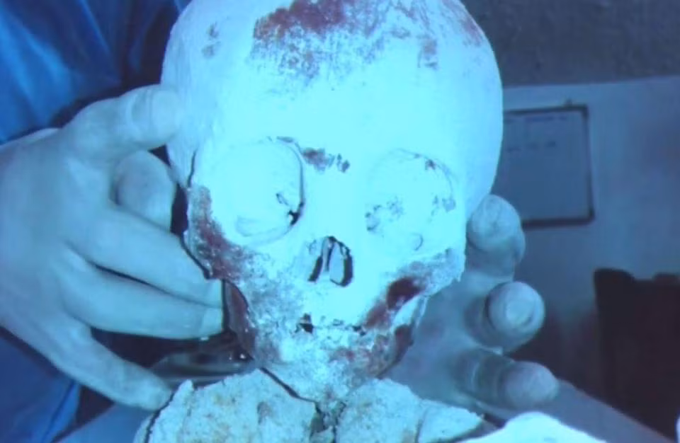 Có quan điểm cho rằng nó chính là xác của người ngoài hành tinh. Hiện 5 xác ướp này đang gây tranh cãi mạnh mẽ trong giới khoa học xoay quanh việc xác định nguồn gốc của nó. Ngoài ra, có người cho đó là giả mạo, chẳng qua là những mẫu thạch cao. Nguồn ảnh: thesun. 