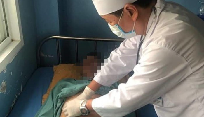 Yen Bai: Cuu song benh nhan bi nhiem “vi khuan an thit nguoi”