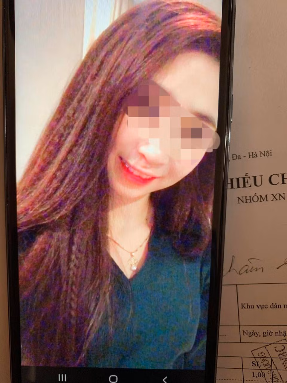 Tại bản kết luận giám định pháp y về tình dục số 22 ngày 28/6/2019, của Trung tâm Pháp y tỉnh Nghệ An, kết luận: “Trên cơ thể cháu Nguyễn B.T không có dấu vết tổn thương, màng trinh hình viền, lỗ màng trinh dãn vừa, không có dấu vết tổn thương ở màng trinh. Hậu môn có hai vị trí sưng nề nhẹ tại điểm 6 giờ và 12 giờ. Các vị trí sưng nề trên do mới xảy ra thời gian gần đây”.