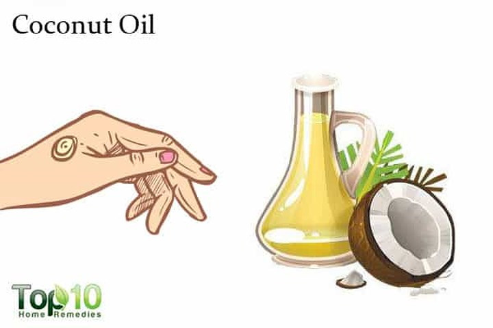 Dầu dừa: Dầu dừa là một chất làm mềm tự nhiên, rất tốt để sử dụng trên da. Hơn nữa, sự kết hợp độc đáo của các axit béo trong dầu dừa rất tốt cho da khô. Nó cũng bảo vệ da khỏi bị tổn hại do các tia cực tím (UV) gây ra.