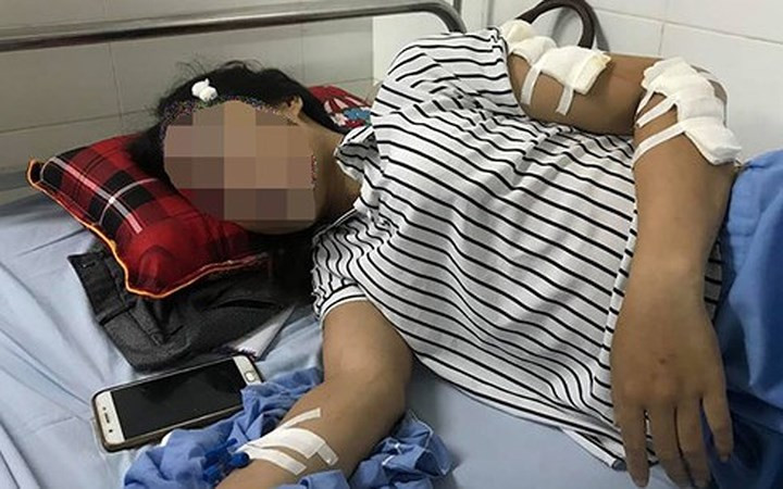 2. Vụ thảm án ở Thái Nguyên: Nạn nhân nói về mâu thuẫn khiến nghi phạm gây án: Liên quan đến vụ án này, ngày 26/9, Cơ quan CSĐT Công an tỉnh Thái Nguyên vẫn đang tạm giữ hình sự đối với Nguyễn Xuân Tiến để điều tra, làm rõ về hành vi giết người. Theo anh Khoa, con rể nghi phạm, trước khi gây án khoảng 10 ngày, anh có đưa bố vợ đi khám bệnh tại Bệnh viện huyện Phú Bình, các bác sĩ kết luận ông Tiến bị đau đầu và ảnh hưởng thần kinh. Anh này cũng cho biết, gia đình vợ anh có một số người mắc bệnh về thần kinh. Trong ảnh, một nạn nhân vụ thảm án đang điều trị tại Bệnh viện. (Ảnh: Báo Thanh niên)