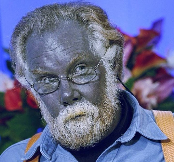 Keo bạc: Là một loại khoáng chất được chiết xuất từ bạc nguyên chất, keo bạc những năm trở lại đây được nhiều người tin dùng bởi đặc tính chữa bệnh của nó. Tuy nhiên, các chuyên gia đã cảnh báo nhiều lần rằng không chỉ không có tác dụng chữa bệnh, keo bạc còn thực sự nguy hiểm cho sức khỏe.