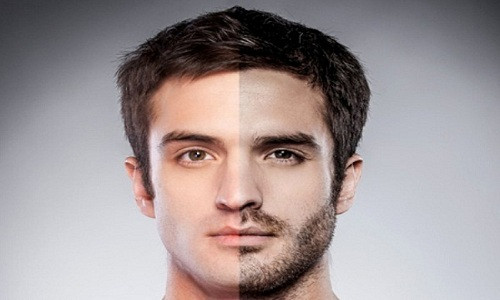 Cấy râu hay lông ngực đang trở thành trào lưu làm đẹp của nam giới. Ảnh minh họa