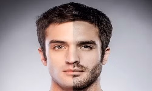 Cấy râu hay lông ngực đang trở thành trào lưu làm đẹp của nam giới. Ảnh minh họa