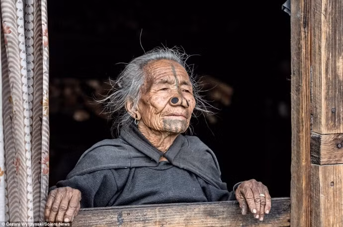 Từ năm 1970 tục lệ này đã được dỡ bỏ.