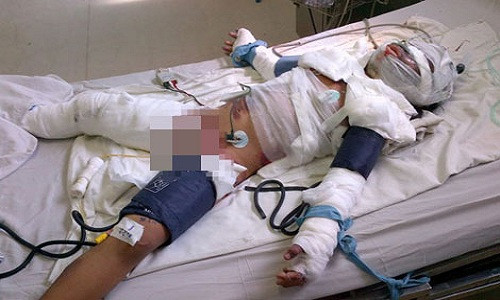 Tu thieu – Lua han thu mang danh toi ac!