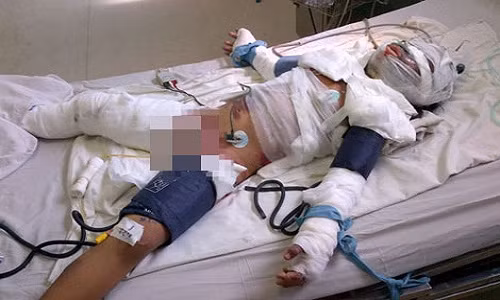 Tu thieu – Lua han thu mang danh toi ac!