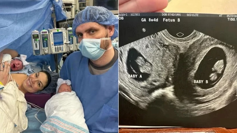 Thai phu co tu cung doi, sinh 2 be gai vao 2 ngay khac nhau