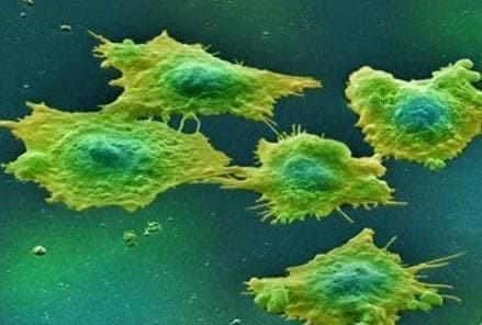 3 loai thuc pham giau tinh kiem la thien dich cua ung thu