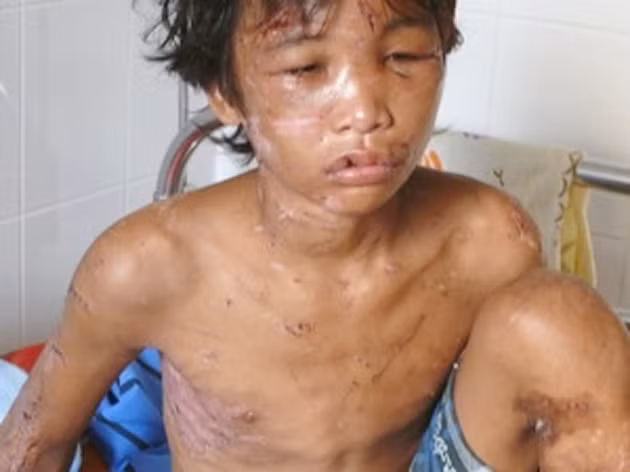 Xot xa nhin lai nhung vu bao hanh tre nho gay chan dong du luan-Hinh-3