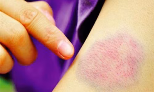 Thấy da thế này đi khám ngay kẻo tới lúc bán nhà cũng chẳng cứu được Thay da the nay di kham ngay keo toi luc ban nha cung chang cuu duoc