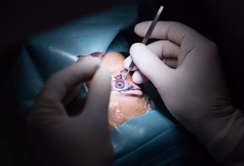 9. Có thể phẫu thuật như LASIK có thể gây ra thị lực mờ tạm thời trong vài ngày tới vài tuần. Hãy để đôi mắt của bạn có thời gian lành lại.